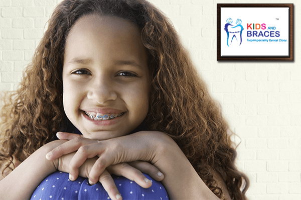 Braces For Kids And Adults
