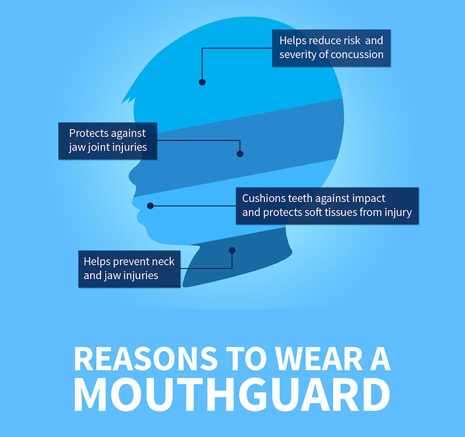 Why To Wear A Mouth Guard